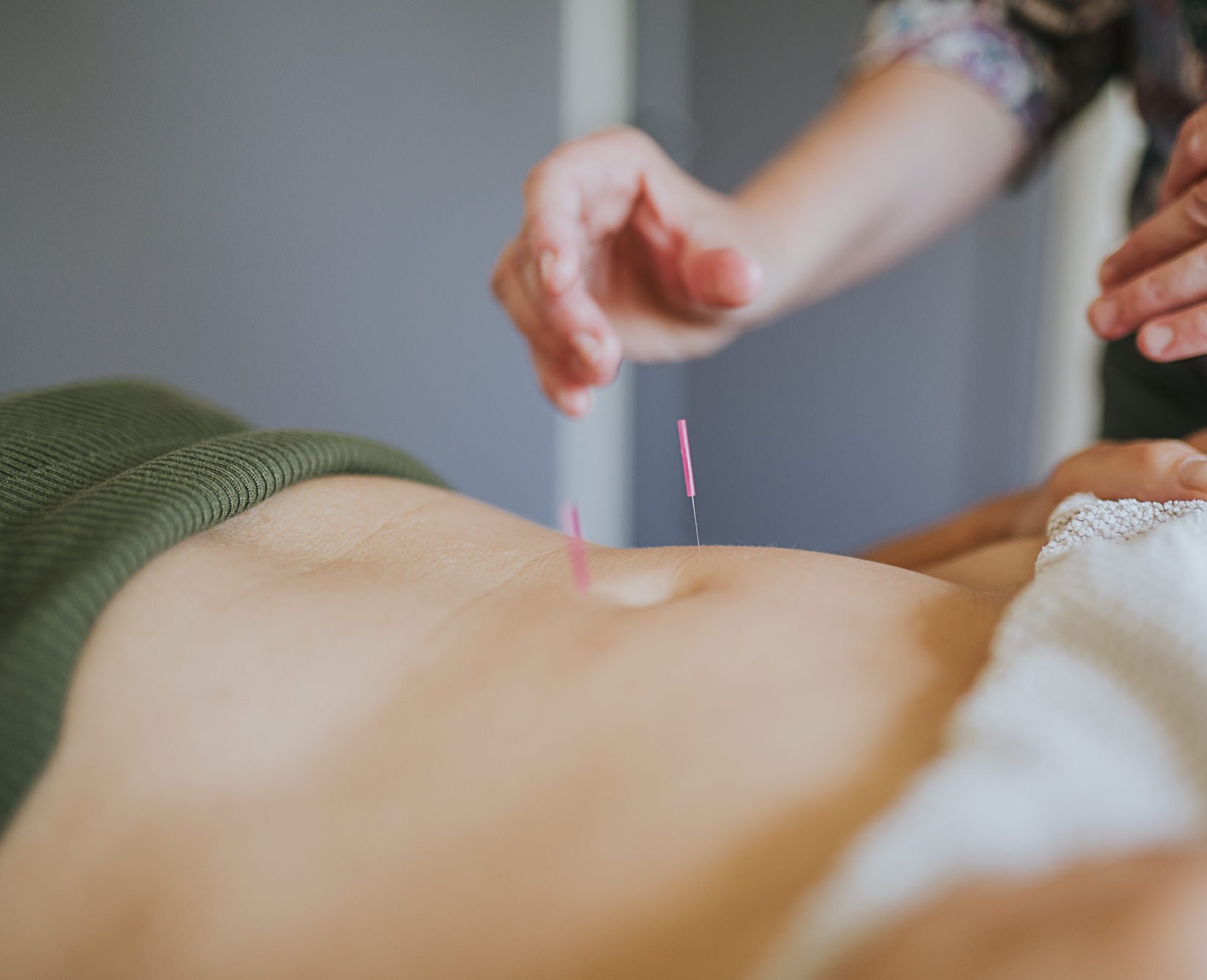 Acupunctuur-bij-oncologie-patienten...